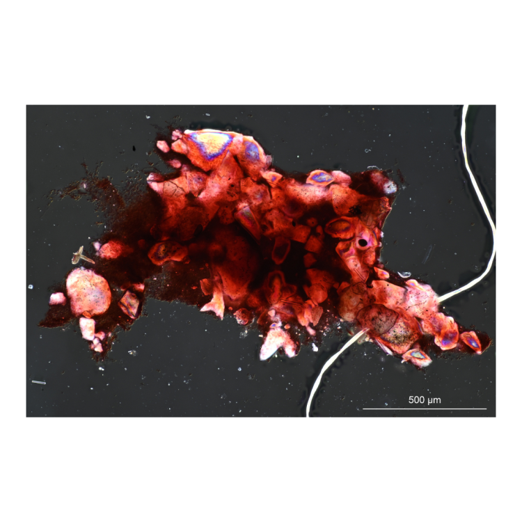 Chelonaplysilla noevus spicule